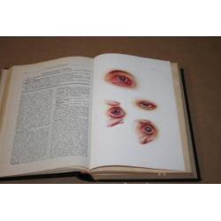 Populair Geneeskundige Encyclopaedie - Bles - 1e druk 1929 !